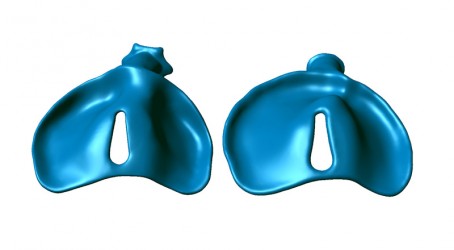 First and last appliances in a series modelled using Geomagic software Article image